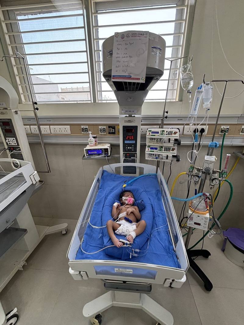 NICU phototherapy